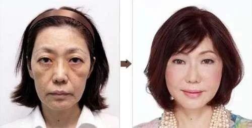 明星大多都去日本整容,日本整形术引领风潮