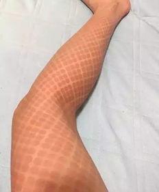 淮北丝袜足疗,体验传统按摩艺术与现代休闲融合之旅